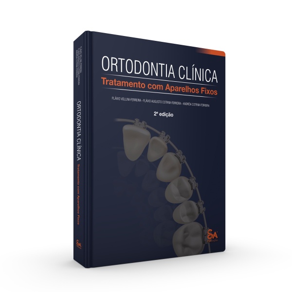 Ortodontia Clinica - Tratamento com Aparelhos Fixos