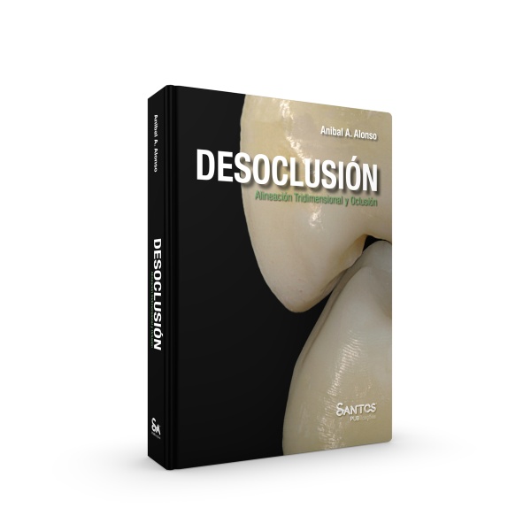 Desoclusión • Alineación Tridimensional Y Oclusión - Ed. Espanhol