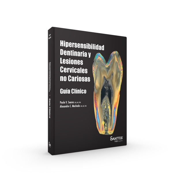 Hipersensibilidad Dentinaria y Lesiones Cervicales no Cariosas – Guía Clínico